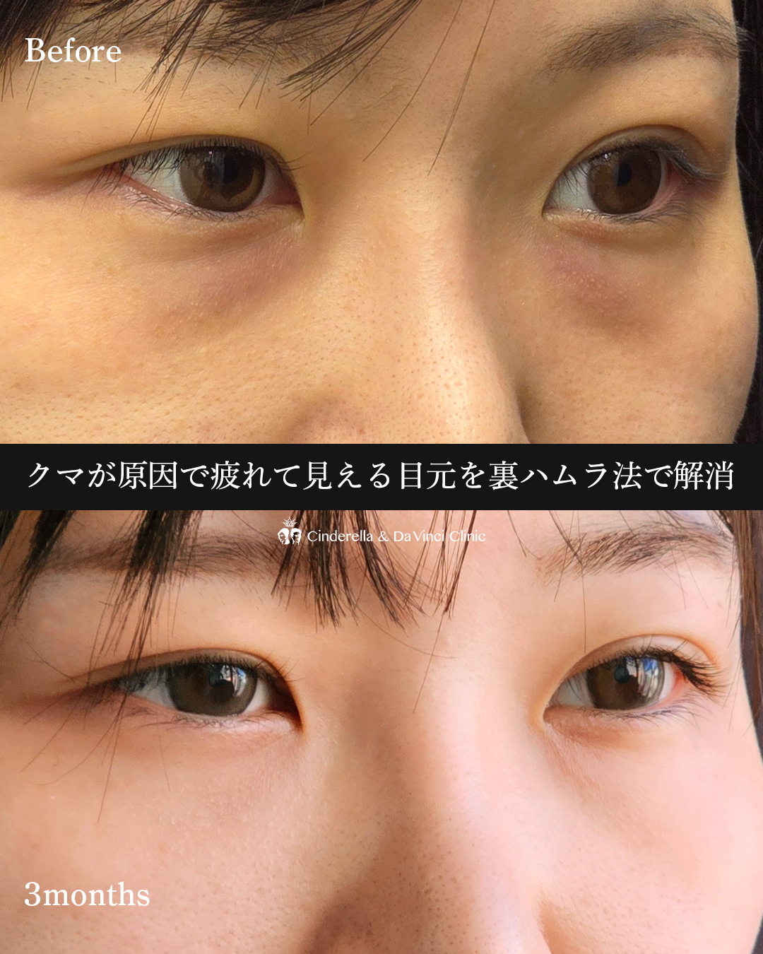 疲れ見え解消の画像