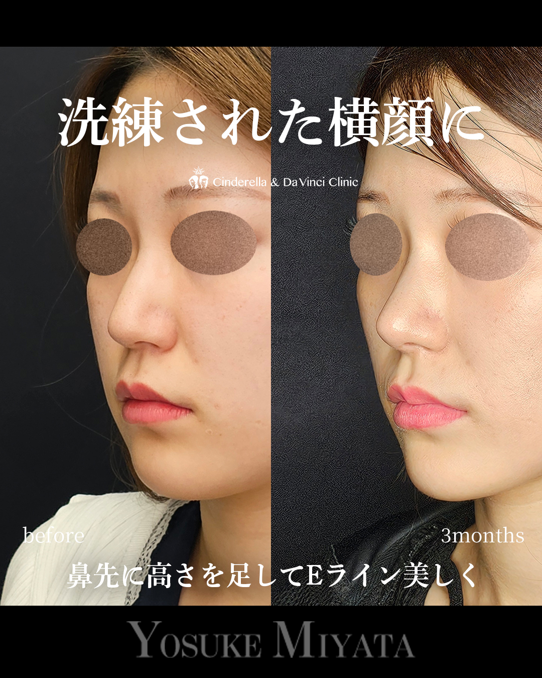 洗練された鼻にの画像