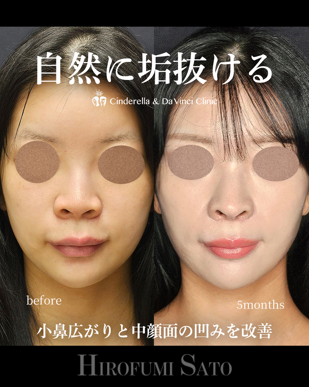 自然に垢抜けの画像