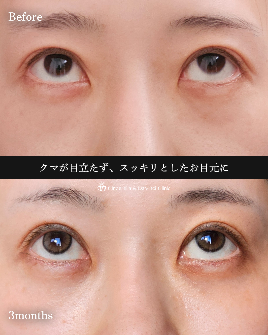 目元すっきりの画像