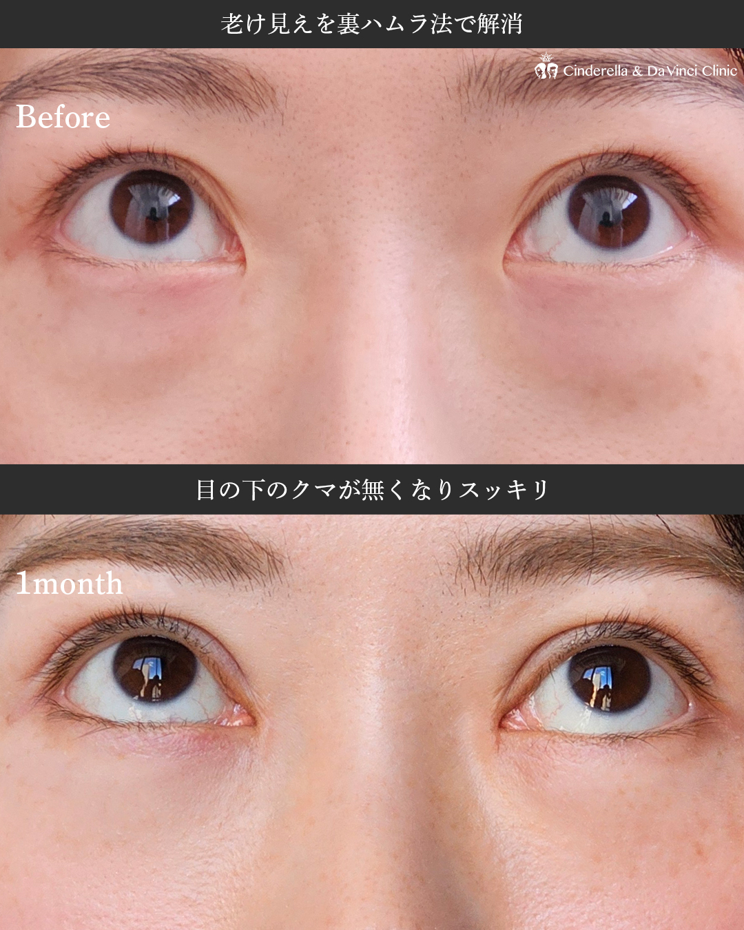 三施術同時の画像