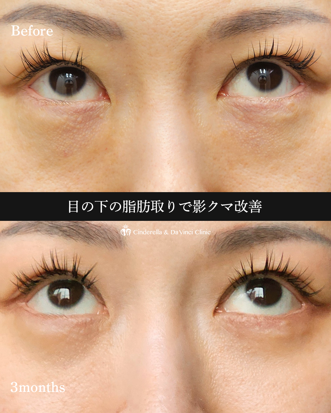 同時施術で変化の画像