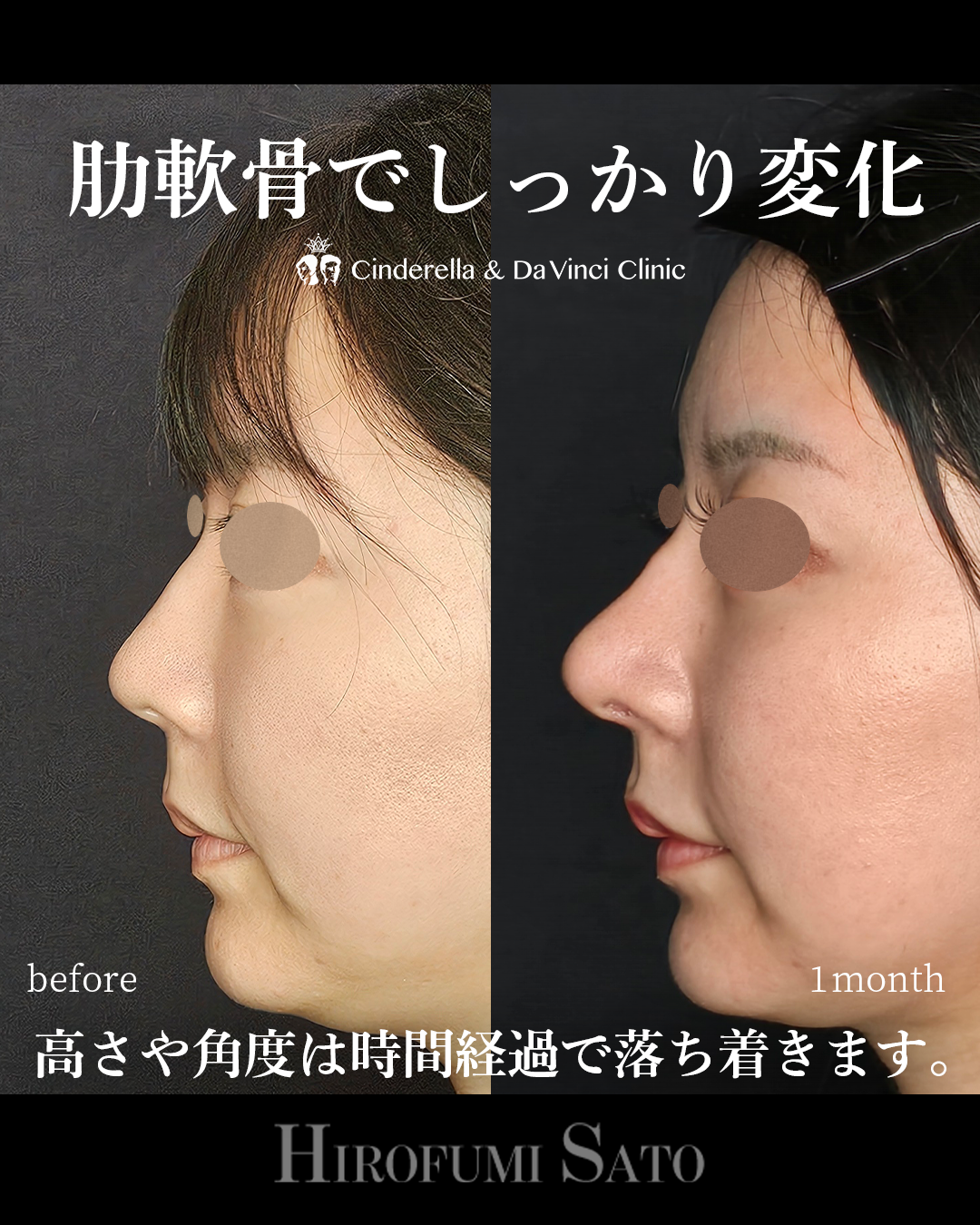 鼻先を前に出すの画像