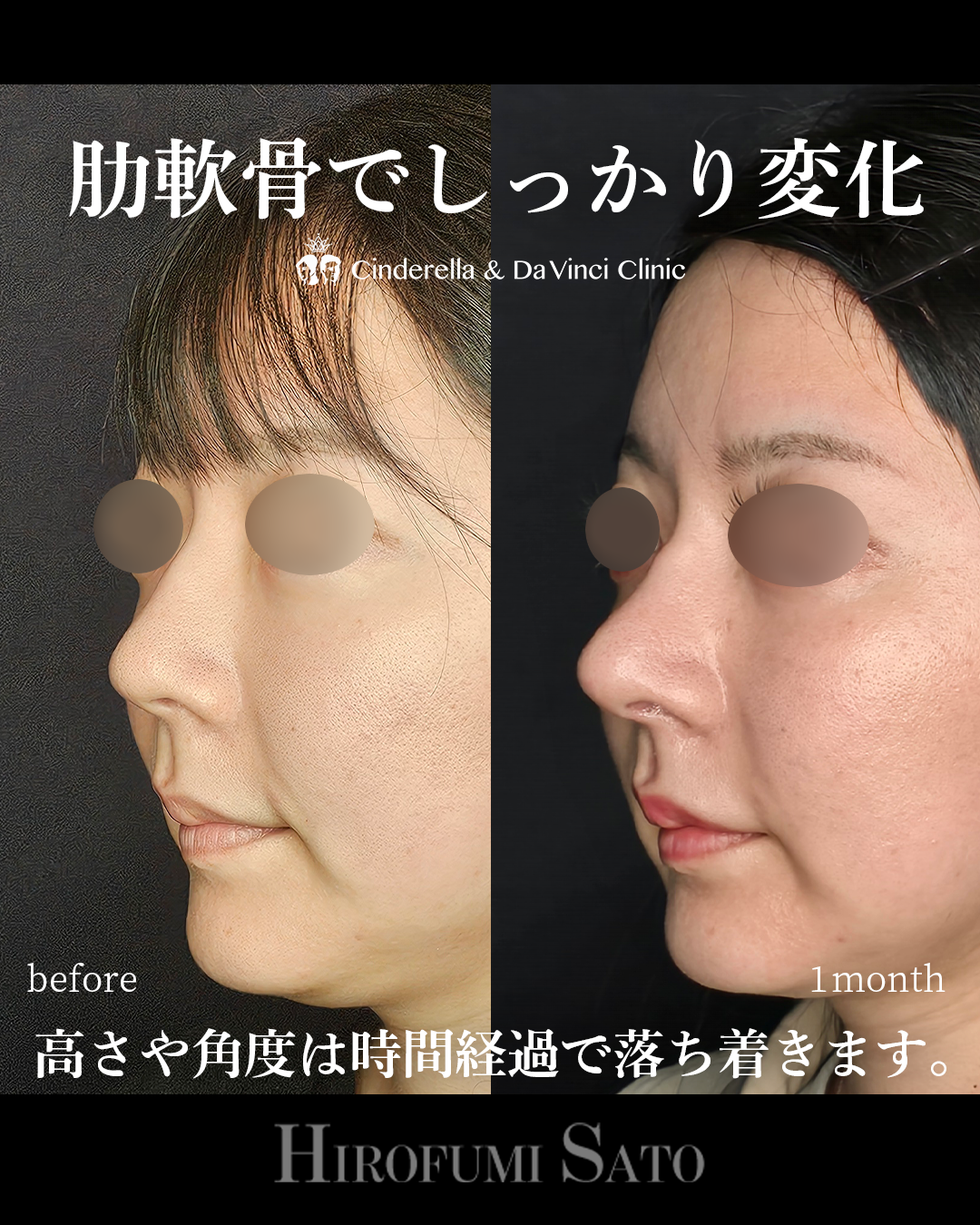 鼻先を前に出すの画像