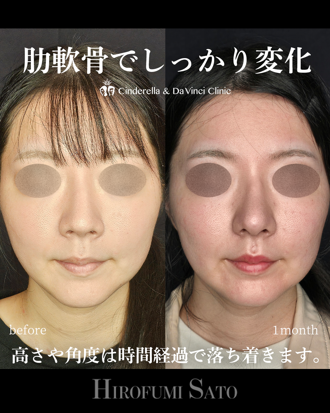 鼻先を前に出すの画像
