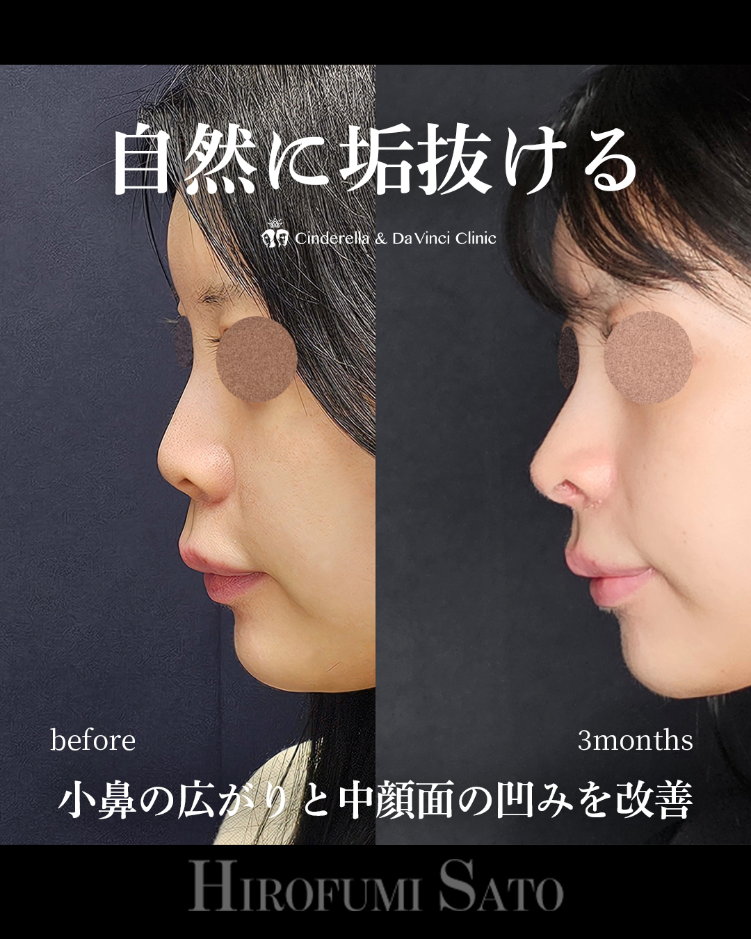 自然に垢抜けの画像