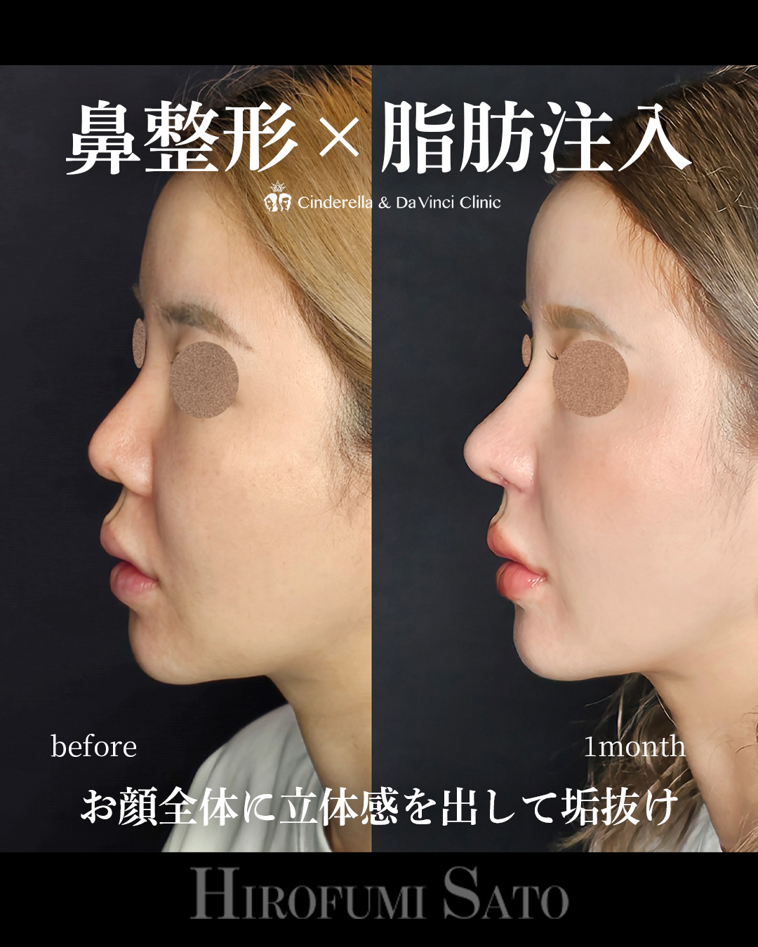 立体感をプラスの画像