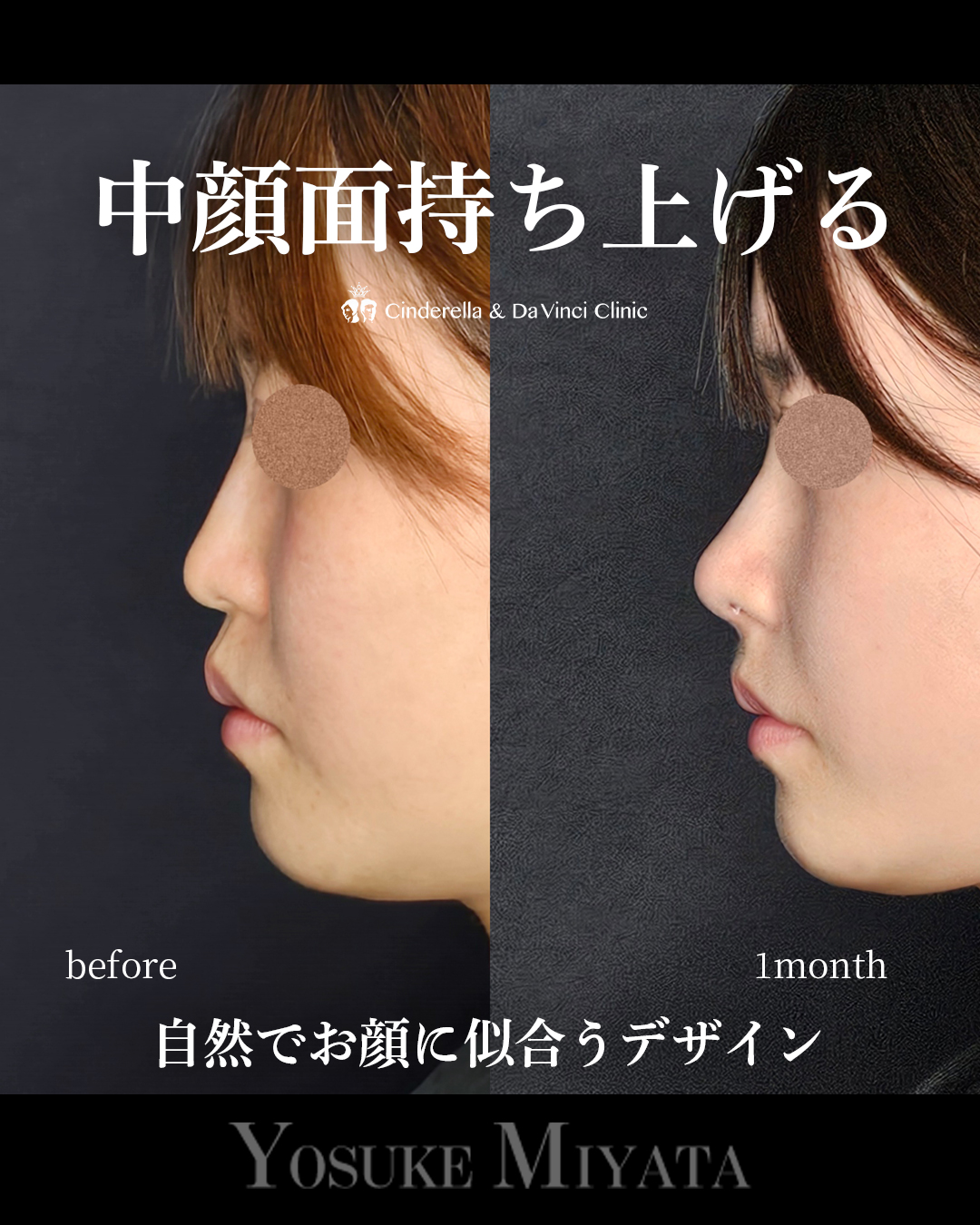 自然で似合う鼻の画像