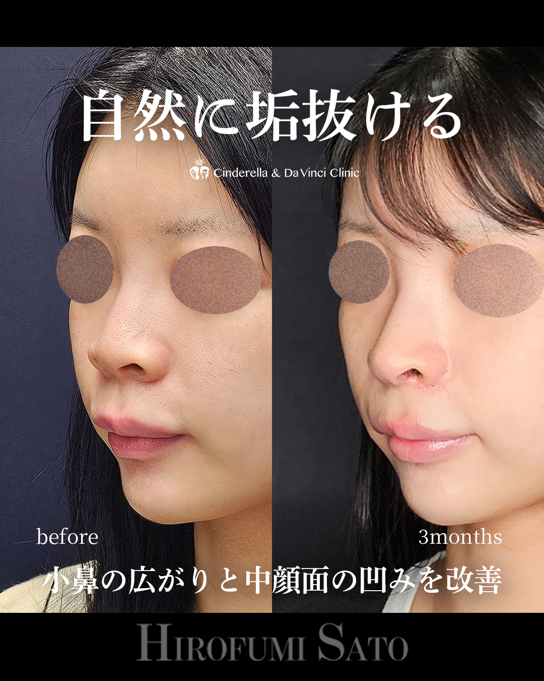 自然に垢抜けの画像