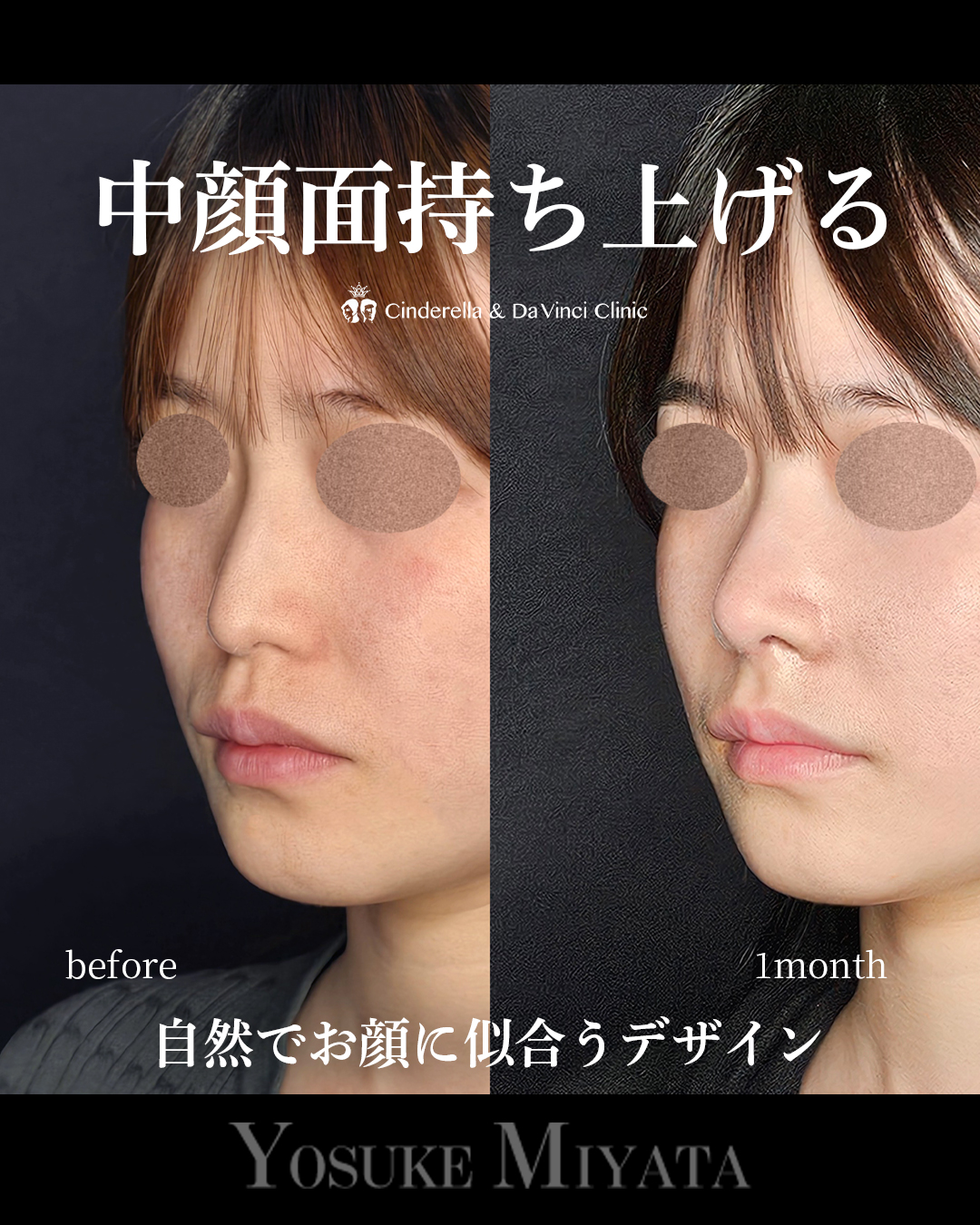 自然で似合う鼻の画像