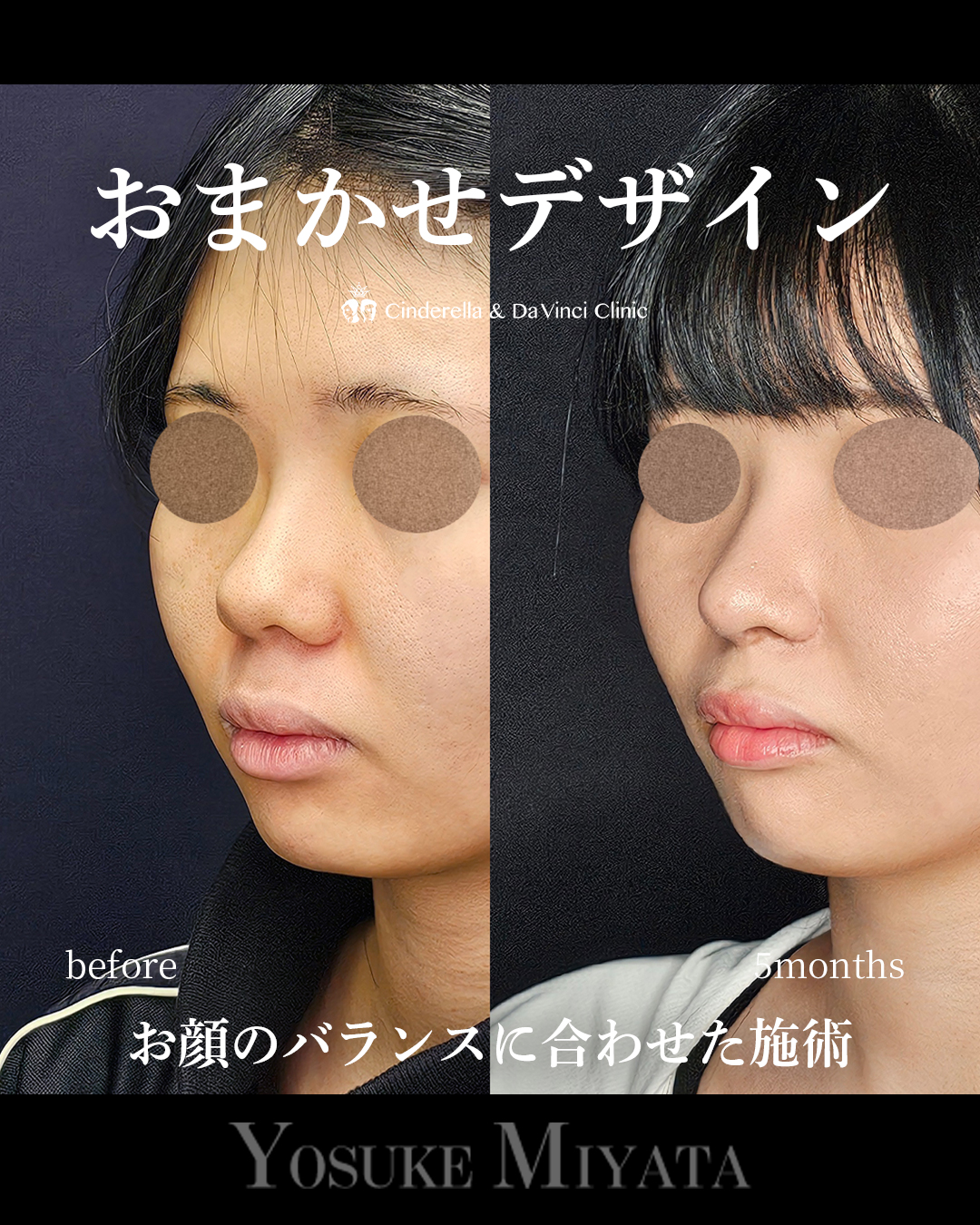 院長におまかせの画像