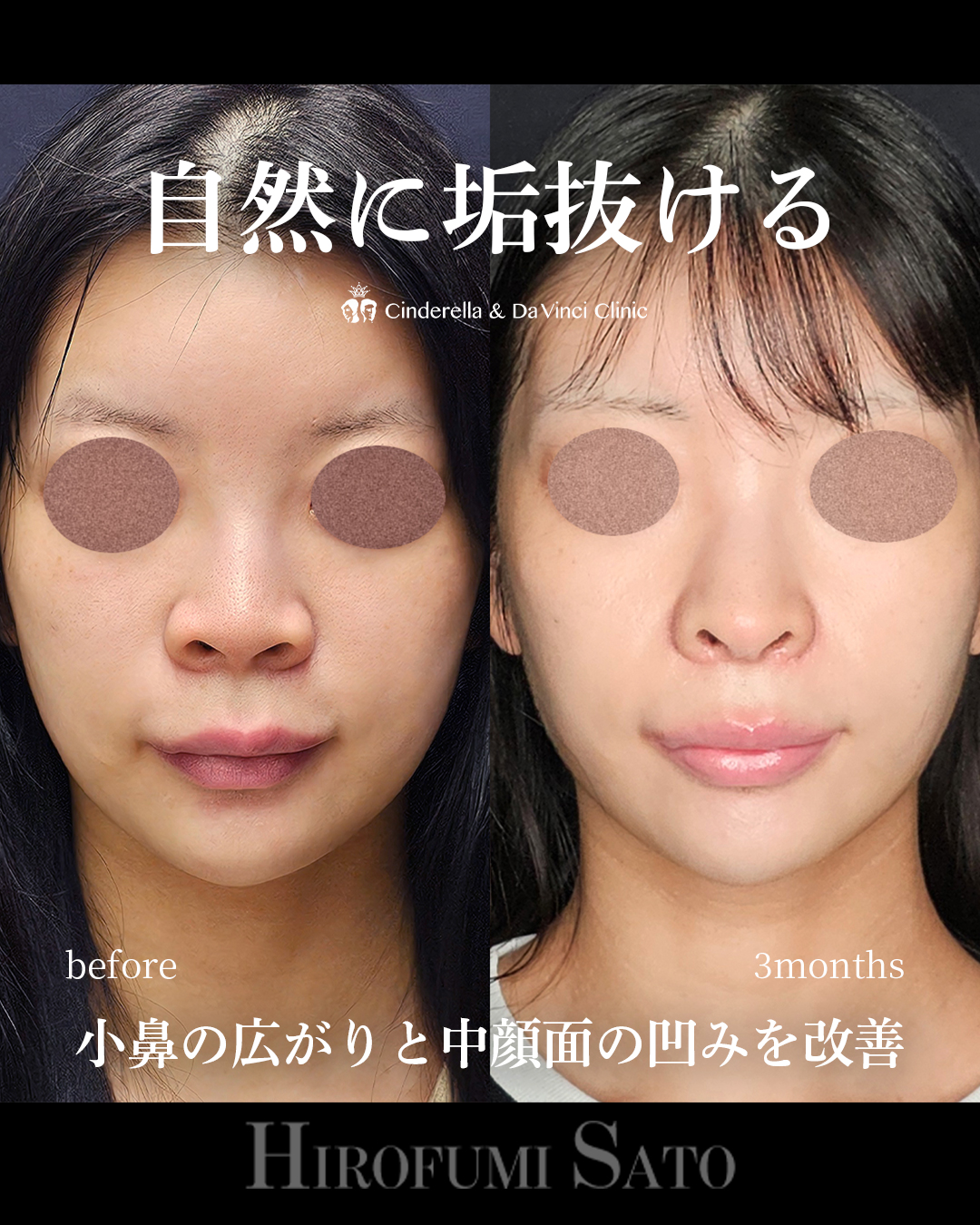 自然に垢抜けの画像