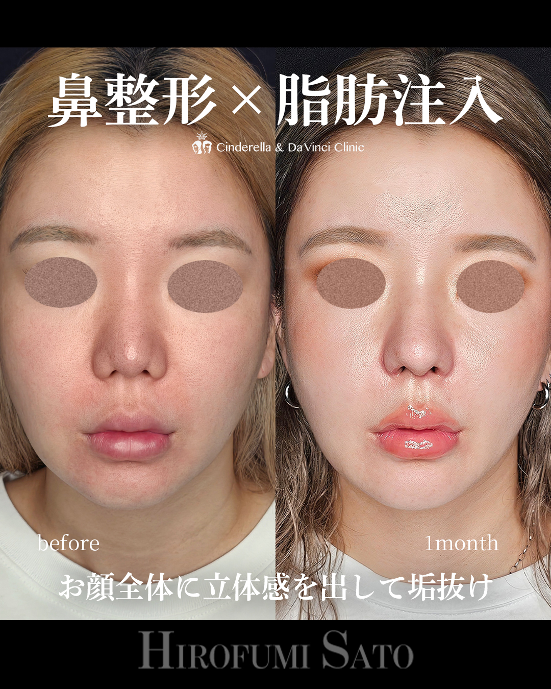 立体感をプラスの画像