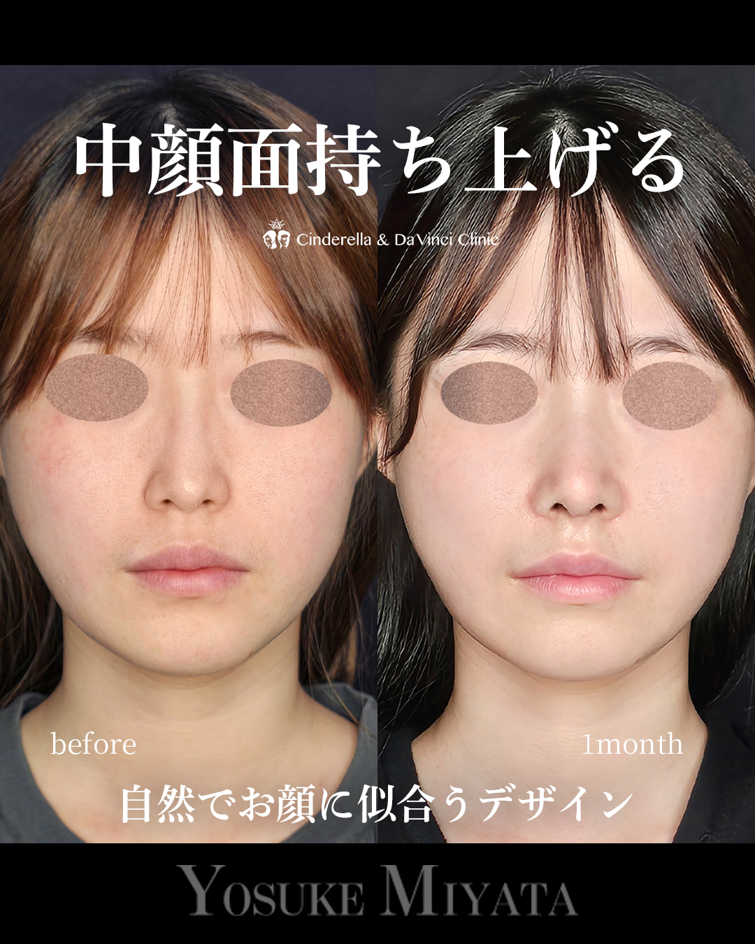 自然で似合う鼻の画像