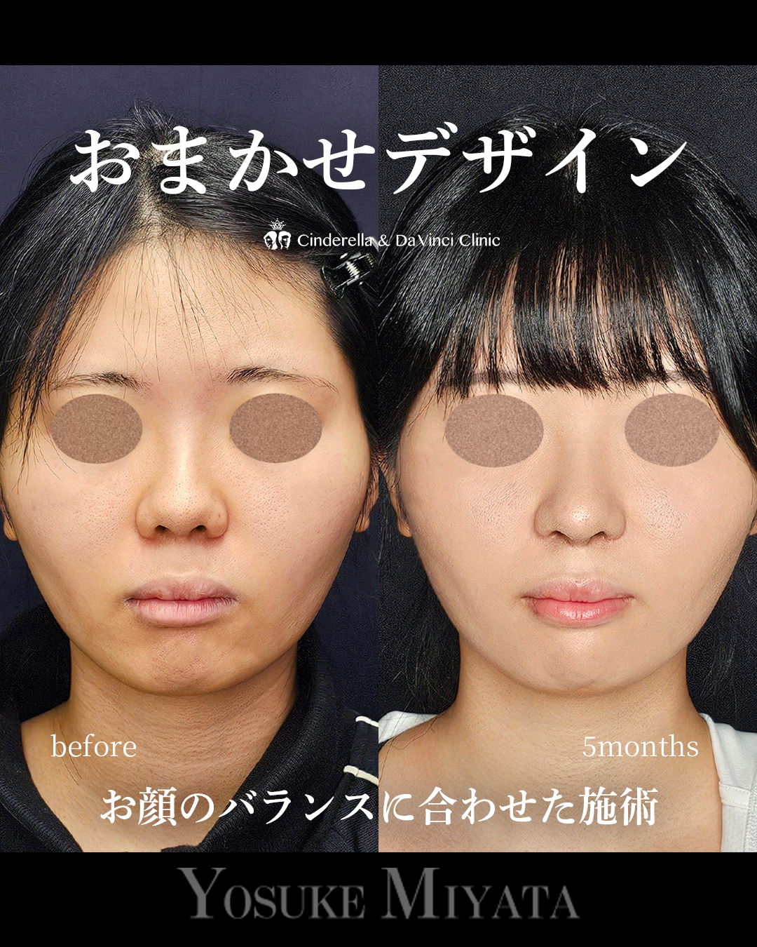 院長におまかせの画像