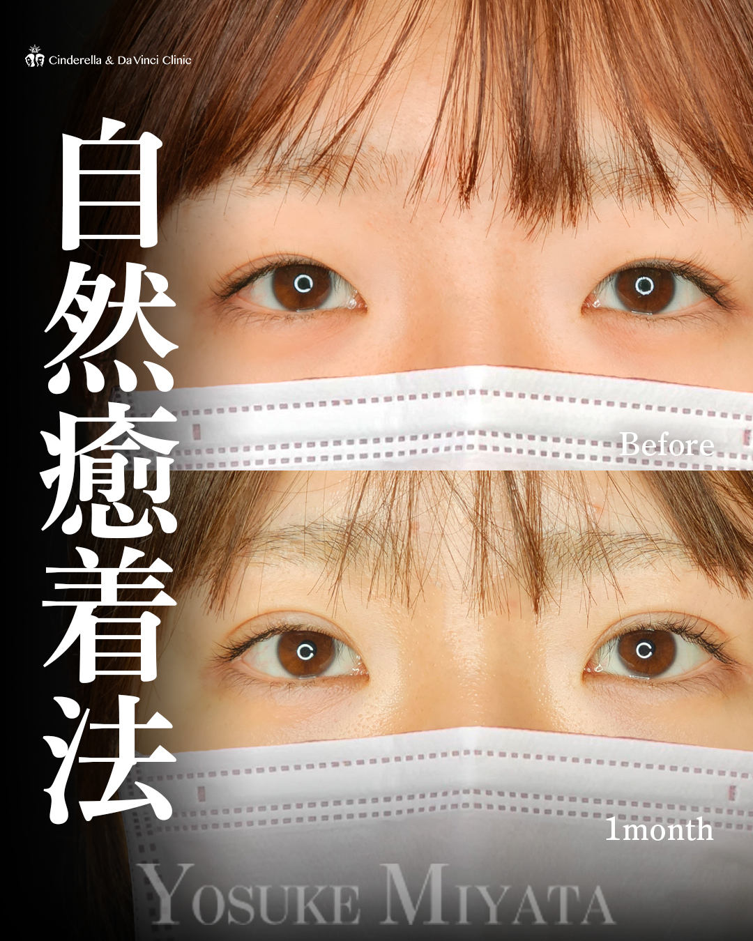理想の二重の画像