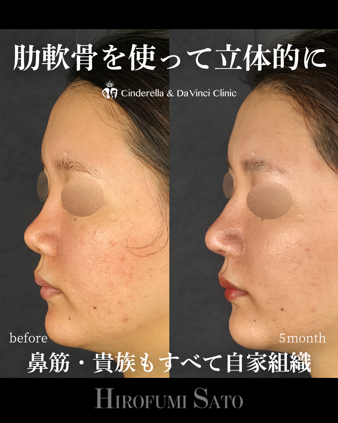 鼻を長く立体的にの画像