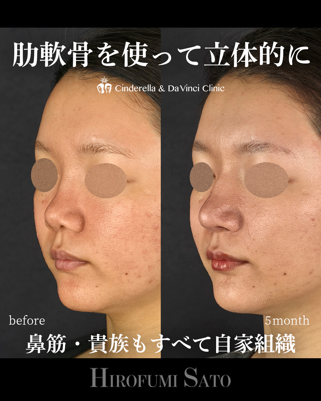 鼻を長く立体的にの画像