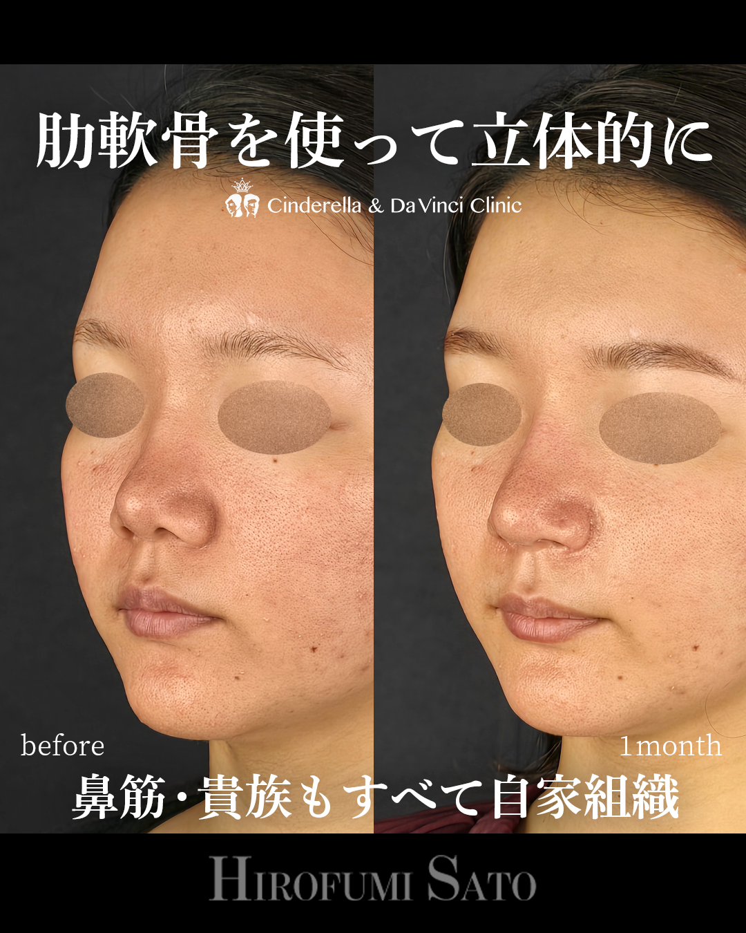 鼻を長く立体的にの画像