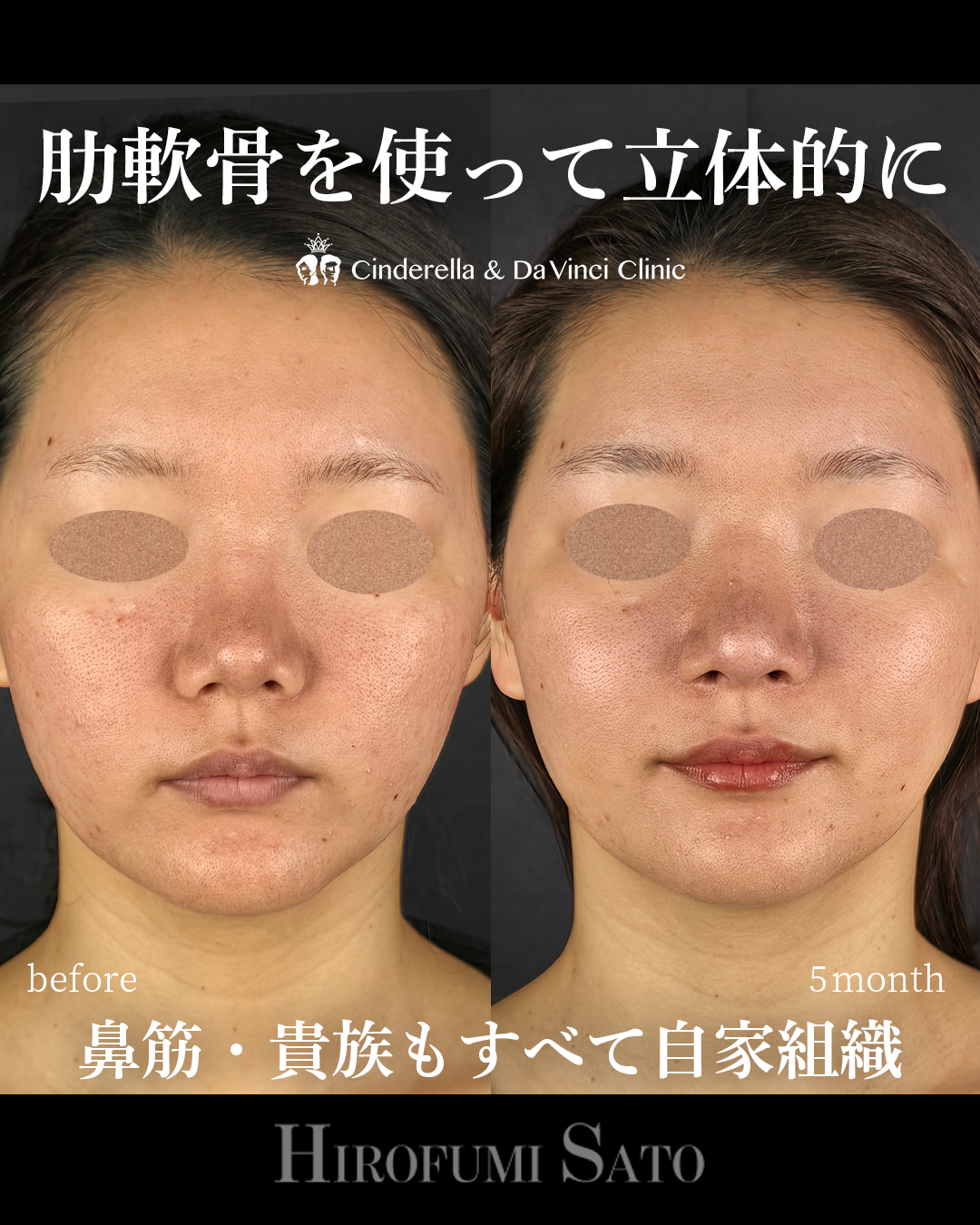 鼻を長く立体的にの画像