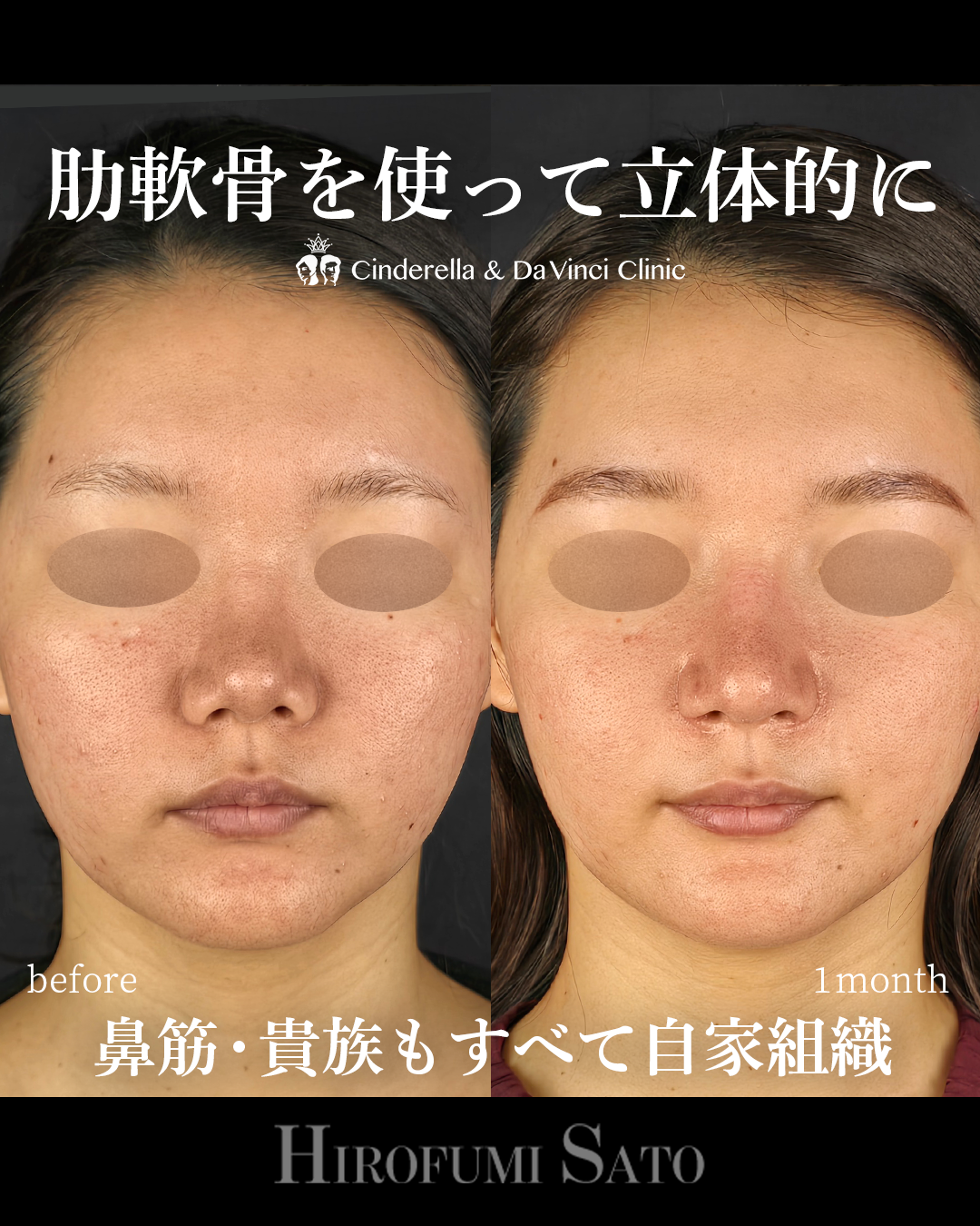鼻を長く立体的にの画像