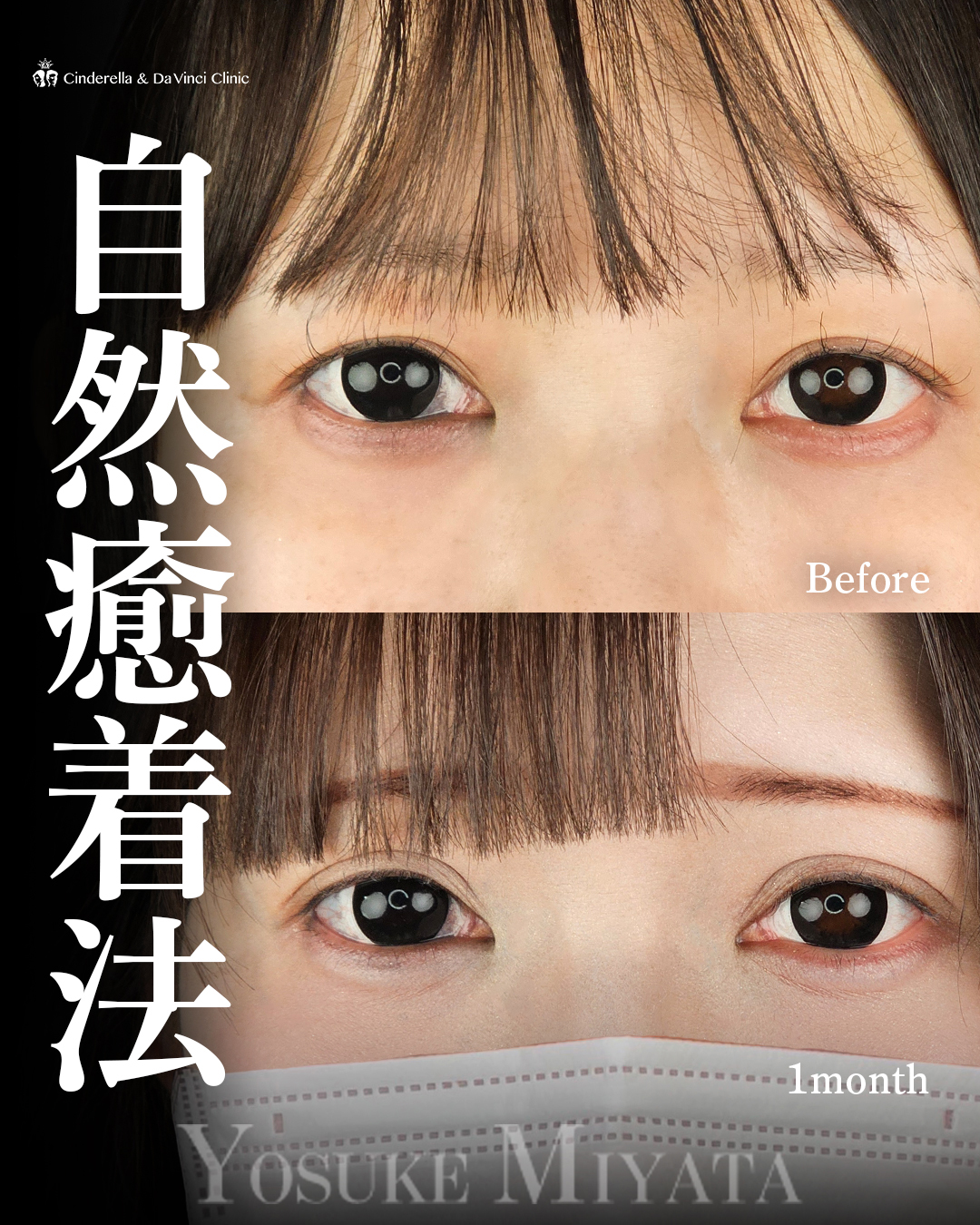 均一な二重ラインにの画像