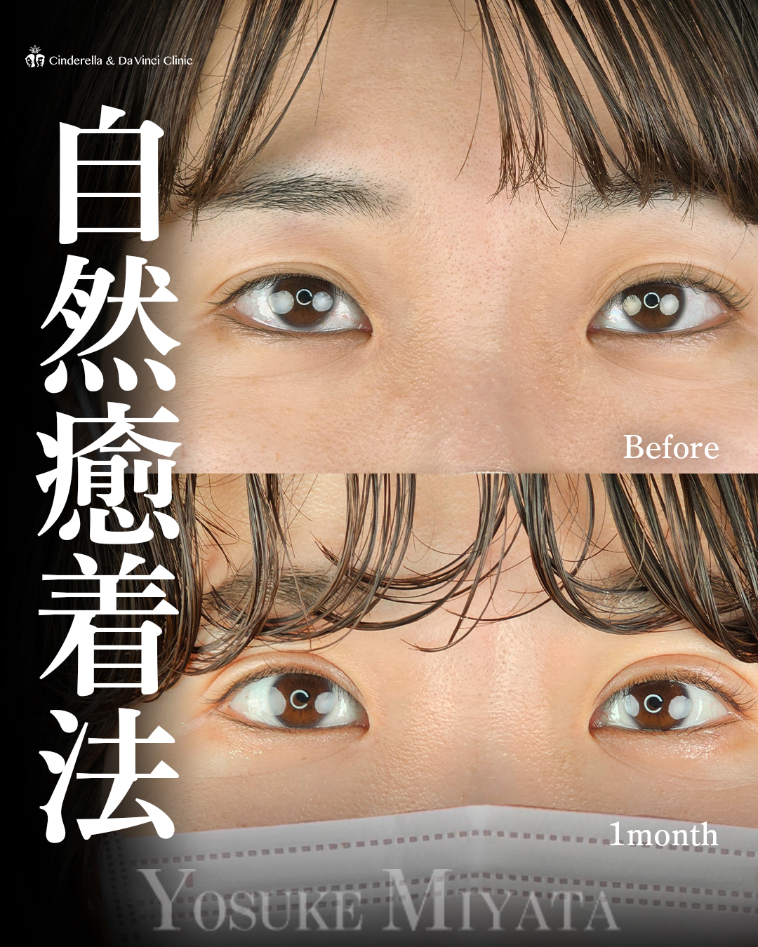 パッチリお目元の画像