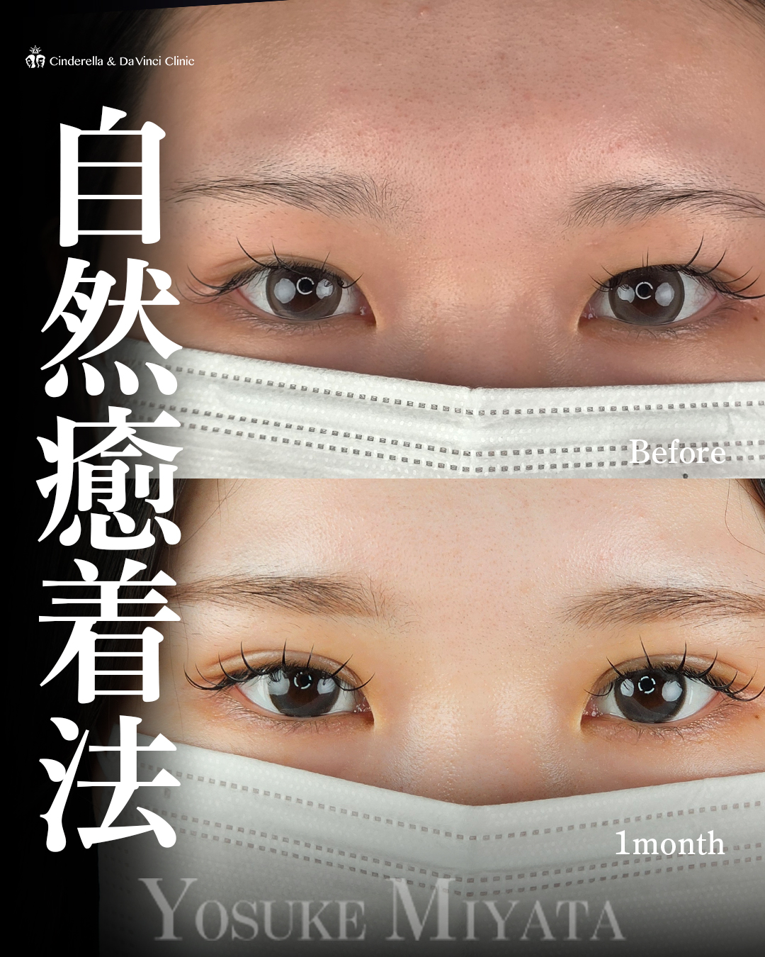 まつ毛が映える二重の画像