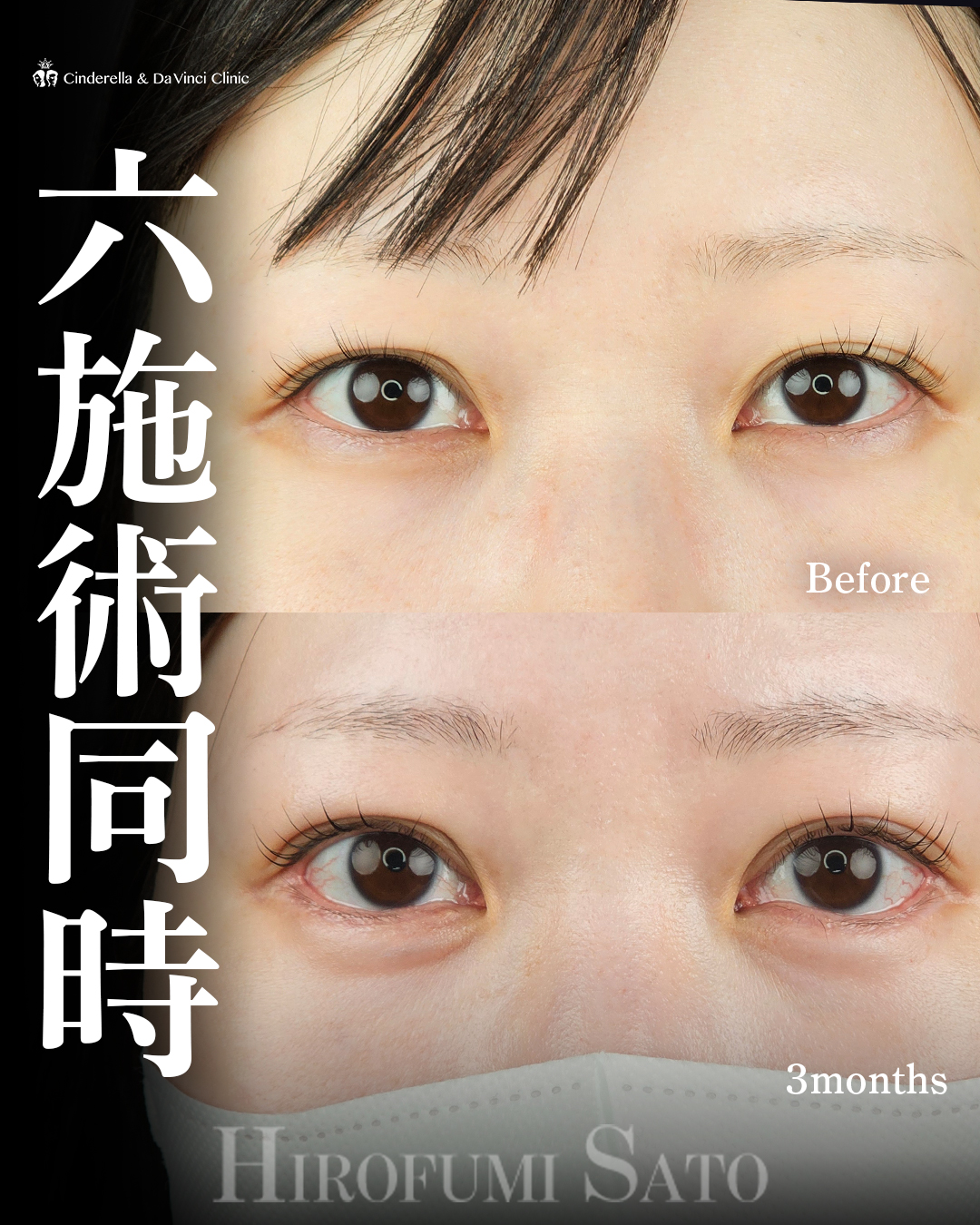 六施術同時の画像