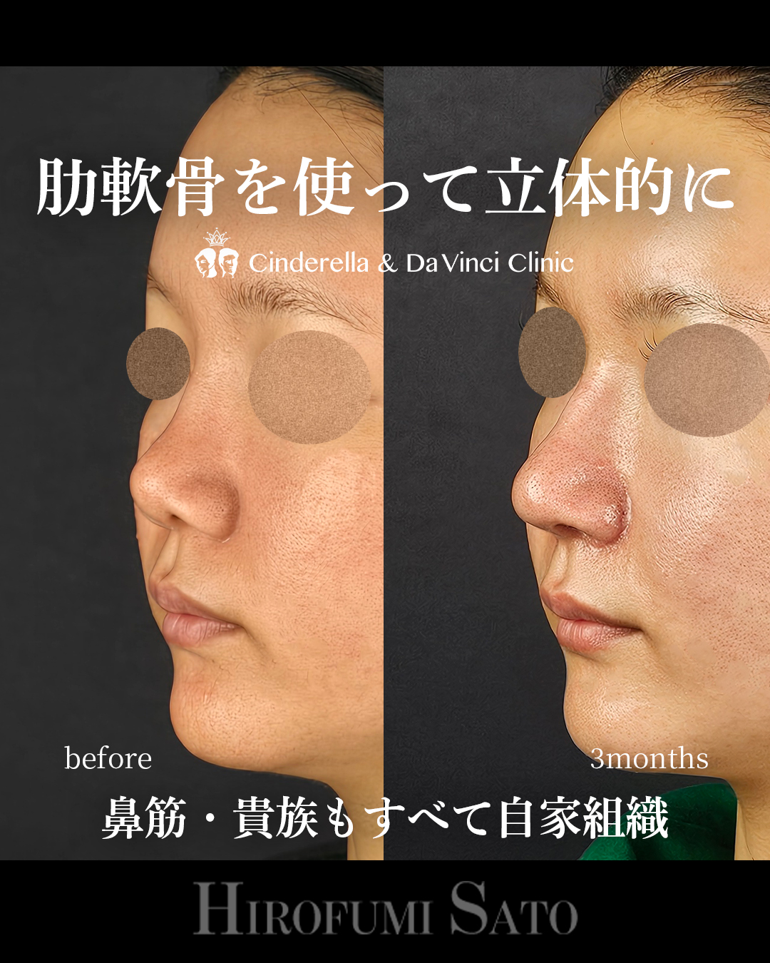 鼻を長く立体的にの画像