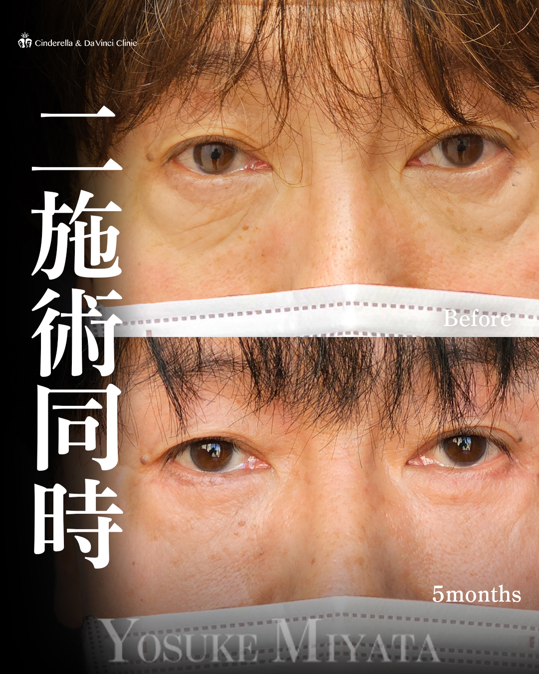 若々しいお目元にの画像