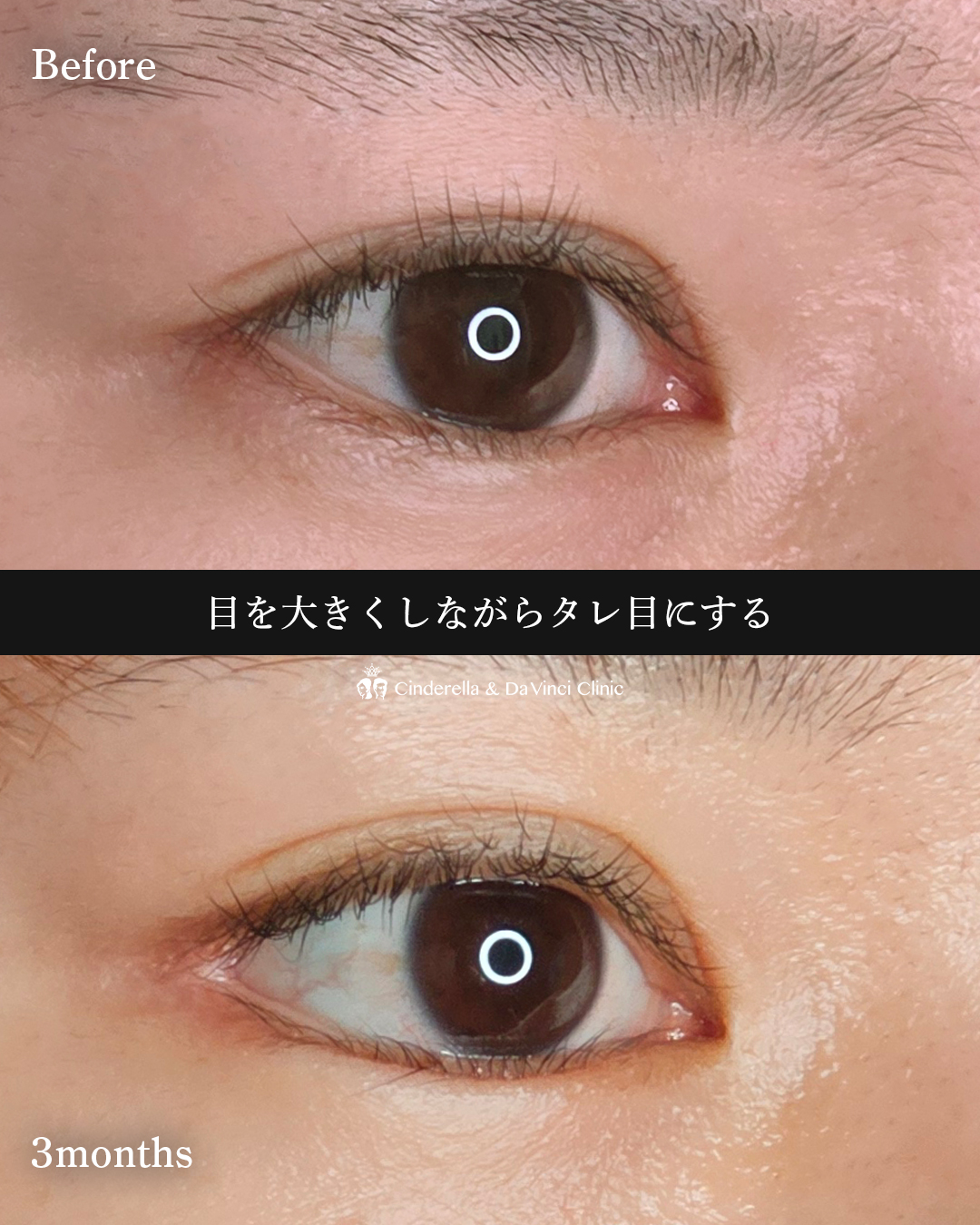 目を大きく見せるの画像