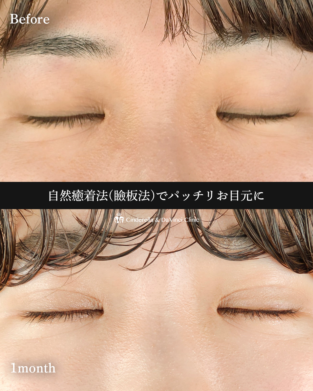 パッチリお目元の画像