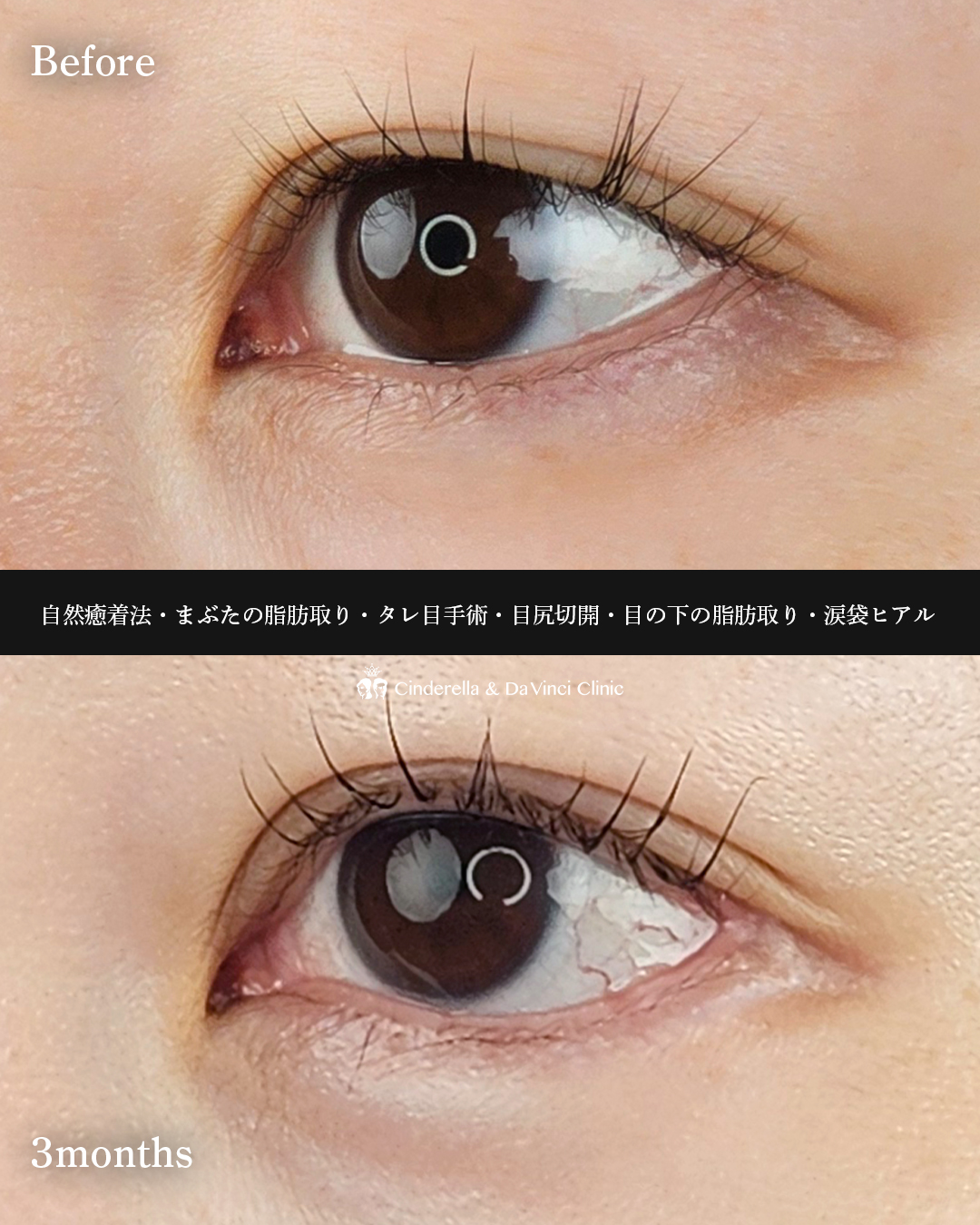 六施術同時の画像