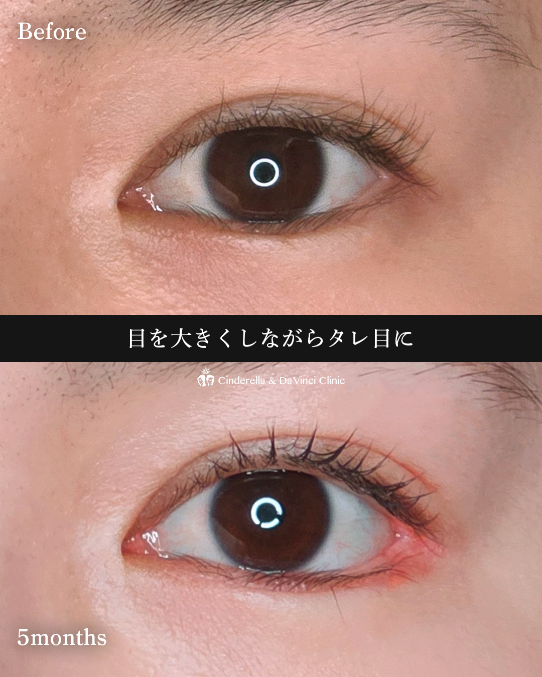 目を大きく見せるの画像