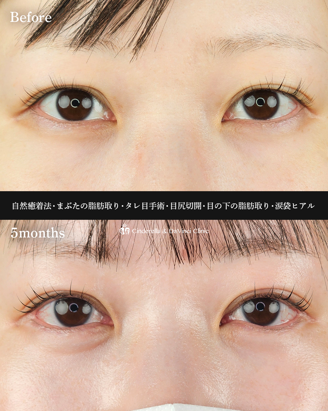 六施術同時の画像