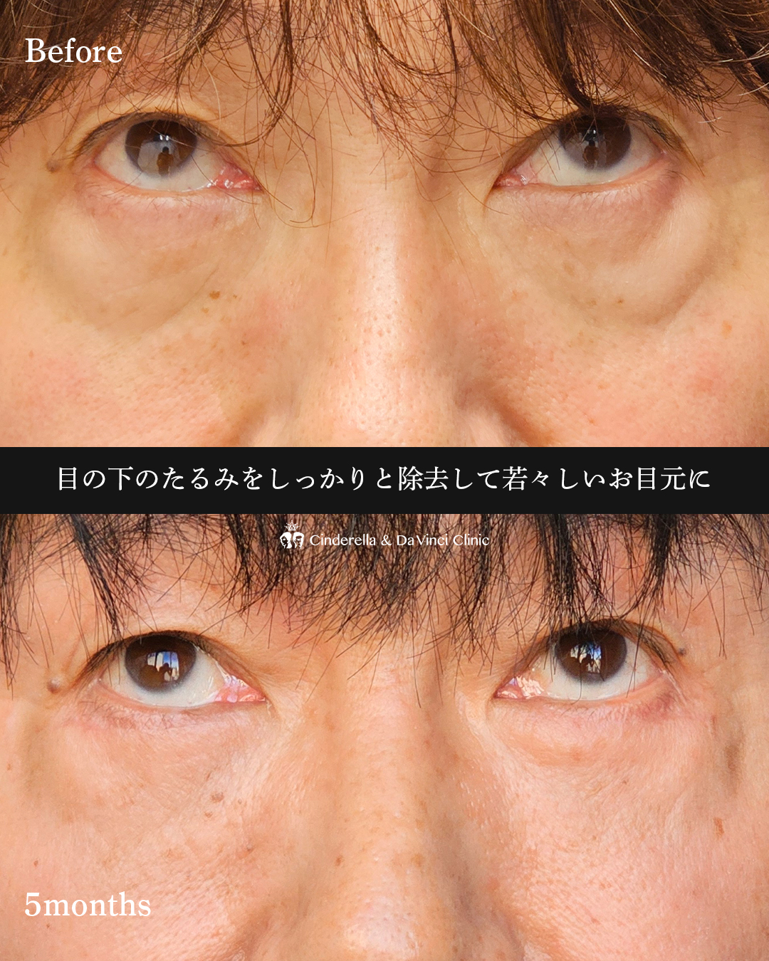 若々しいお目元にの画像