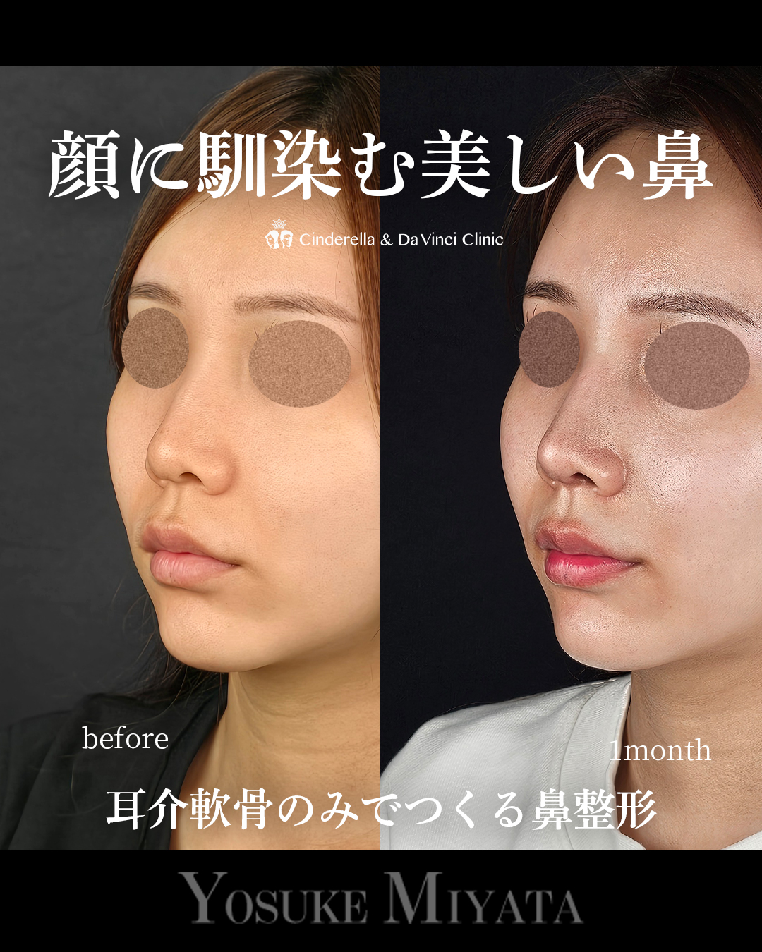 顔に馴染む鼻の画像