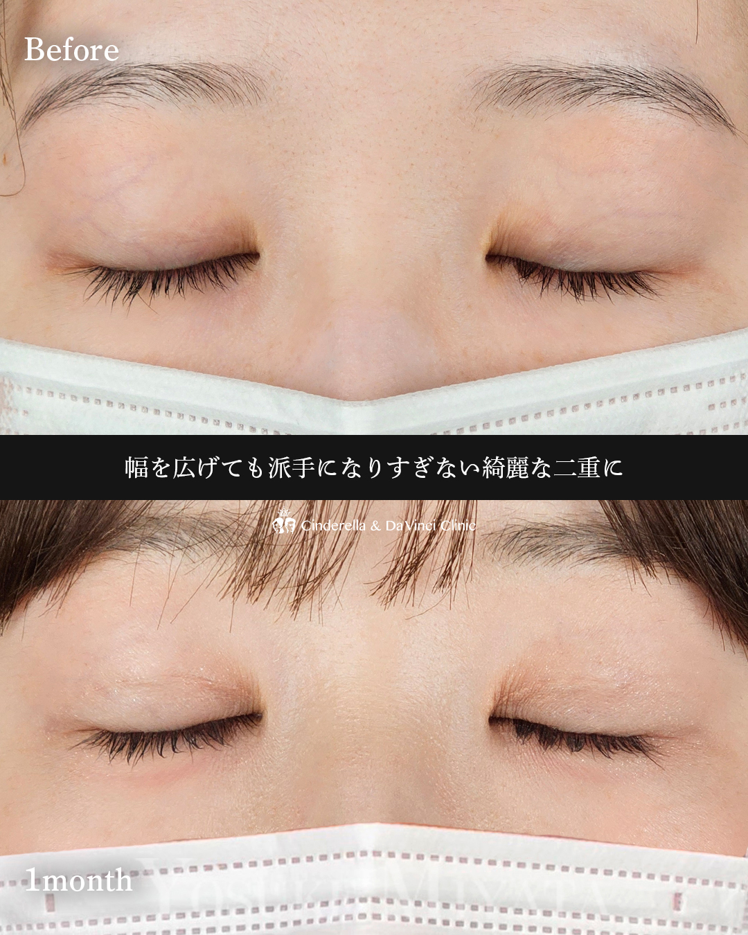 幅を広げる二重の画像
