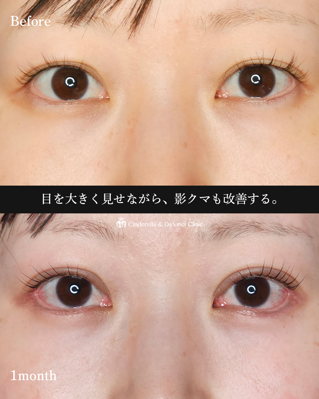 5施術同時の画像