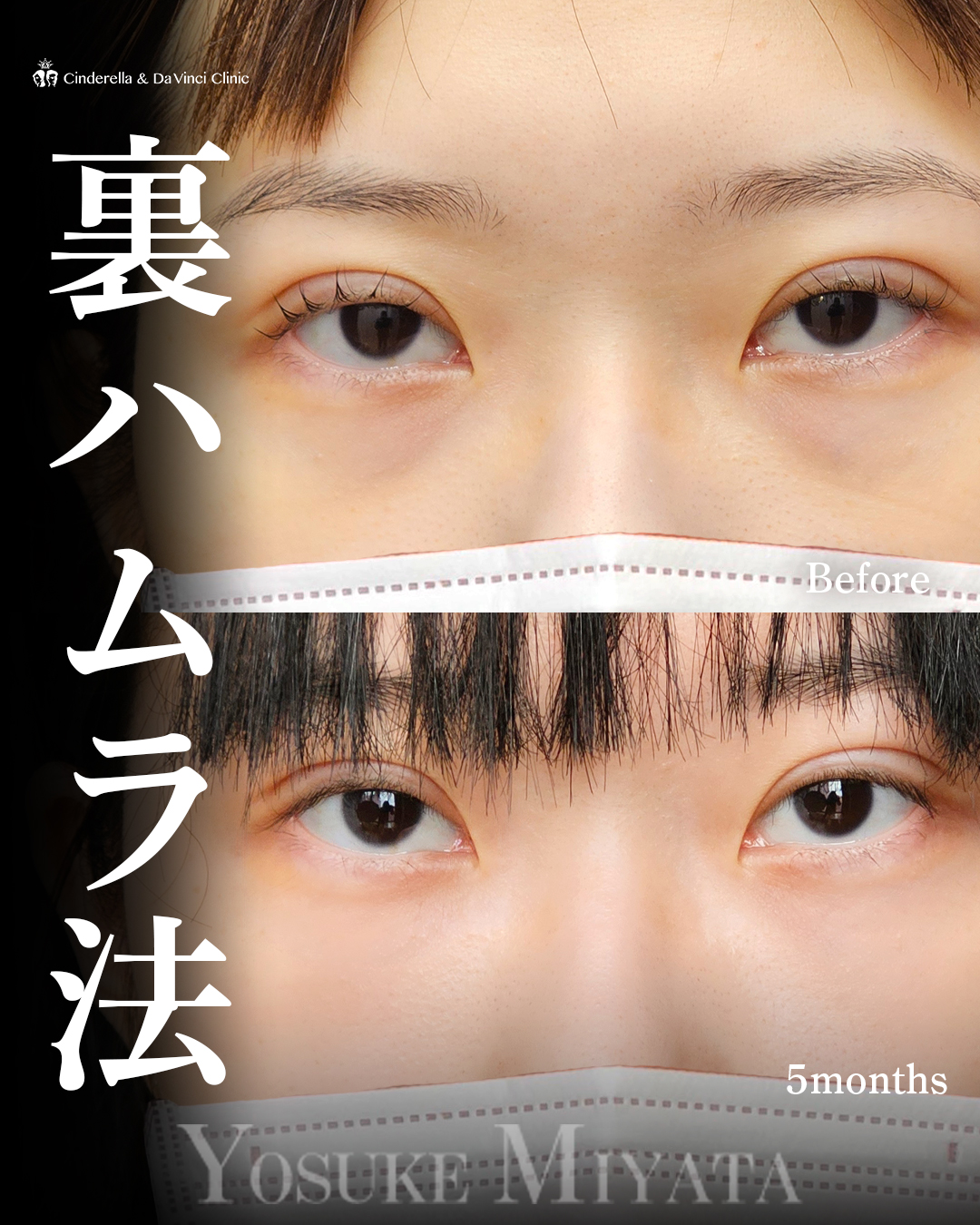 クマすっきりの画像