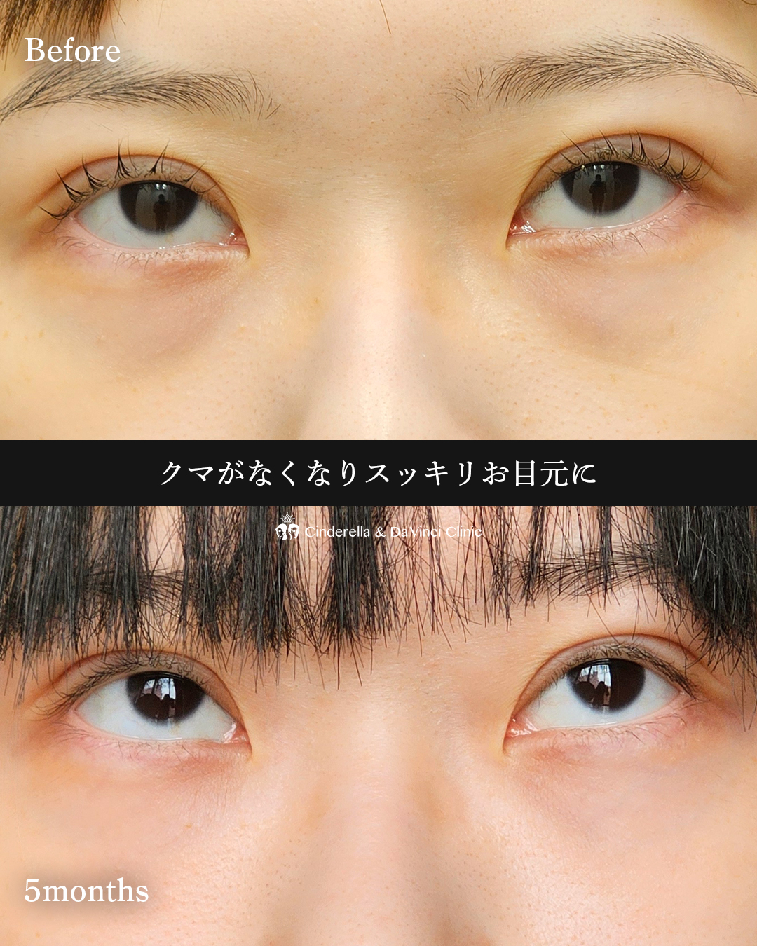 クマすっきりの画像