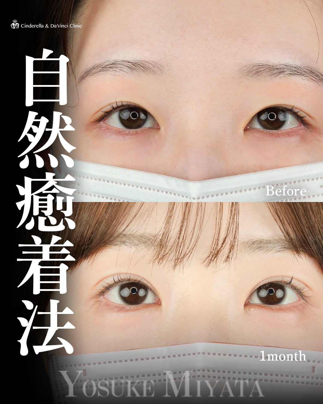 幅を広げる二重の画像