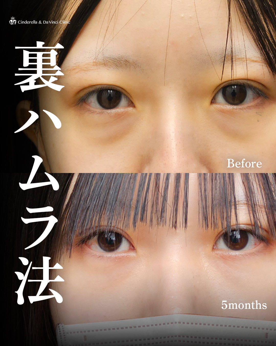 影クマ改善の画像