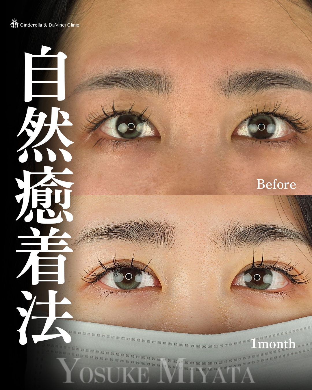 まつ毛映えの二重の画像