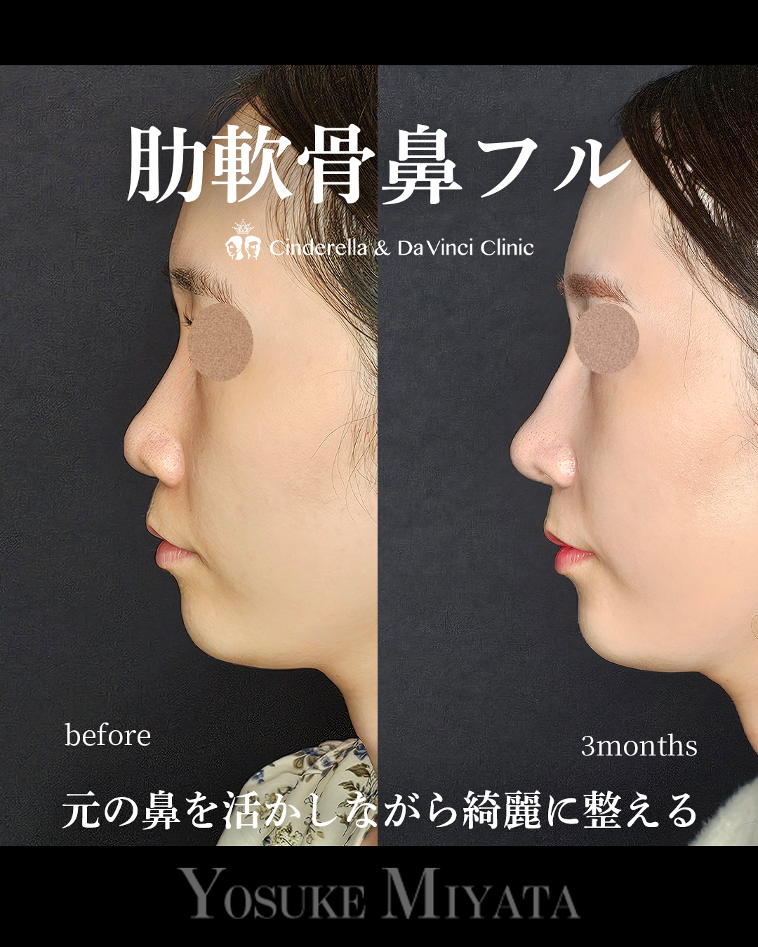 ナチュラルアプデの画像