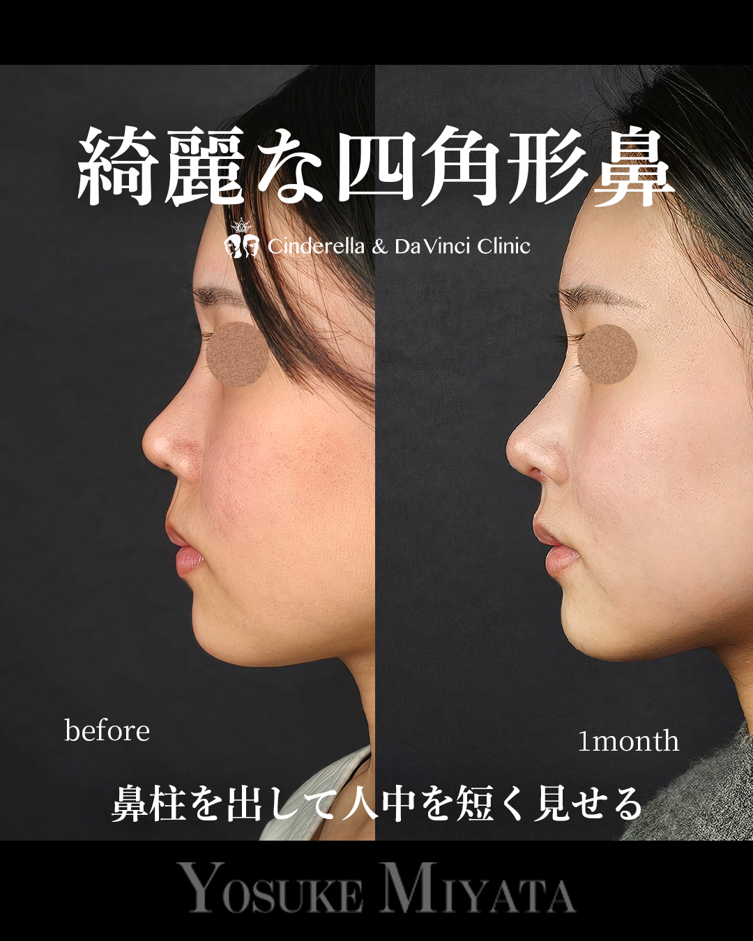 綺麗な四角形鼻の画像