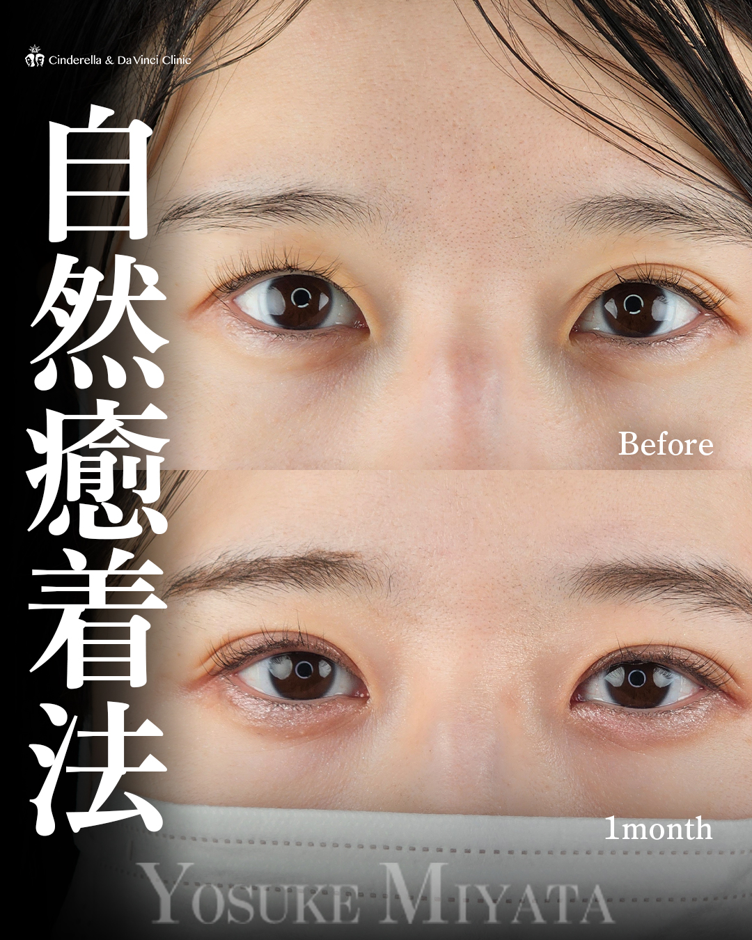 左右差改善の画像