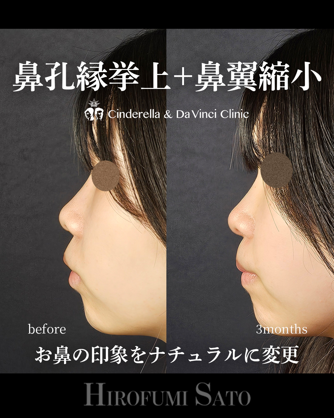 自然に印象を変えるの画像