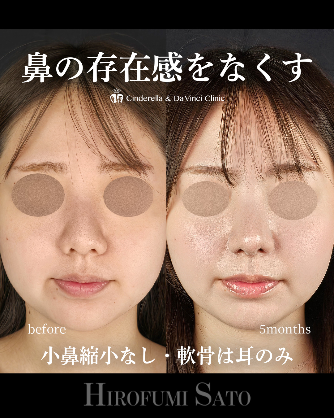 鼻の存在感をなくすの画像